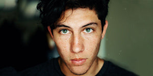 Young man with freckled skin and green eyes, staring directly at the camera.