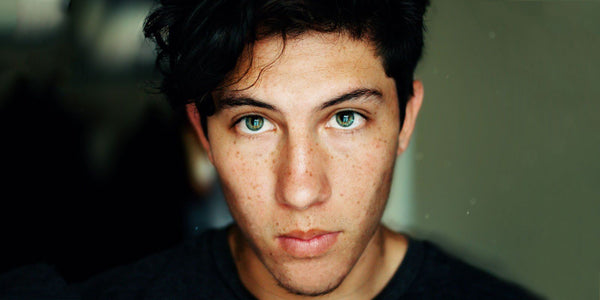 Young man with freckled skin and green eyes, staring directly at the camera.