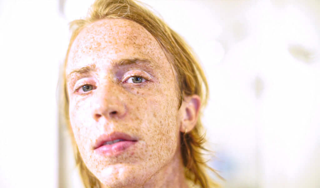 Close-up of a person with freckled skin, showcasing unique complexion and features, ideal for skin type discussion.