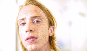 Close-up of a person with freckled skin, showcasing unique complexion and features, ideal for skin type discussion.